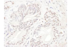 Immunohistochemistry (IHC) image for anti-ELK1, Member of ETS Oncogene Family (ELK1) (AA 200-250) antibody (ABIN7454491)