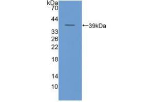 Western blot analysis of recombinant Human uPAR. (PLAUR antibody  (AA 221-305))