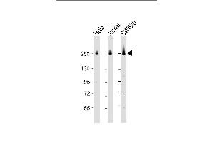 All lanes : Anti-CAD Antibody (Center) at 1:2000 dilution Lane 1: Hela whole cell lysate Lane 2: Jurkat whole cell lysate Lane 3: S whole cell lysate Lysates/proteins at 20 μg per lane. (CAD antibody  (AA 780-809))
