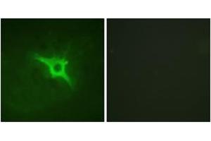 Immunofluorescence analysis of NIH-3T3 cells, using p47 phox (Ab-328) Antibody.