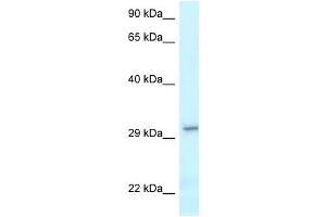 Western Blot showing VTI1B antibody used at a concentration of 1 ug/ml against NCI-H226 Cell Lysate (VTI1B antibody  (C-Term))