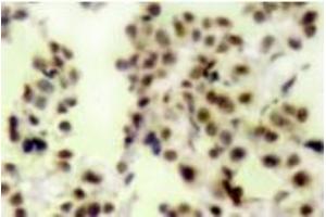Image no. 2 for anti-Tumor Protein P73 (TP73) (pTyr99) antibody (ABIN318099) (Tumor Protein p73 antibody  (pTyr99))