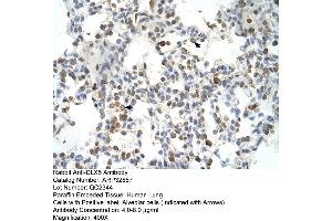 Human Lung (DLX5 antibody  (Middle Region))