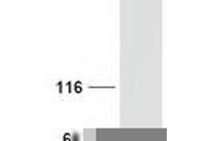 Validation with Western Blot (NOVA1 Protein (Transcript Variant 1) (Myc-DYKDDDDK Tag))