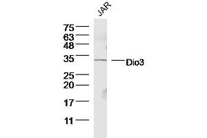Human JAR lysates probed with Dio3 Polyclonal Antibody, Unconjugated  at 1:300 dilution and 4˚C overnight incubation. (DIO3 antibody  (AA 51-150))