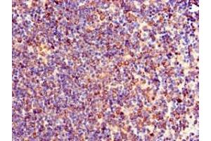 Immunohistochemistry of paraffin-embedded human lymph node tissue using ABIN7174076 at dilution of 1:100 (TXK antibody  (AA 32-83))