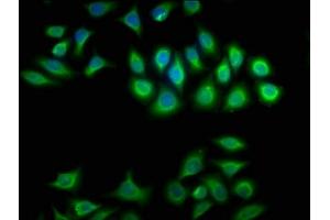 Immunofluorescence staining of A549 cells with ABIN7145462 at 1:100, counter-stained with DAPI. (CRYBA1 antibody  (AA 1-215))
