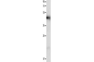 Gel: 12 % SDS-PAGE, Lysate: 40 μg, Lane: Human liver cancer tissue, Primary antibody: ABIN7191316(LRP1 Antibody) at dilution 1/1250, Secondary antibody: Goat anti rabbit IgG at 1/8000 dilution, Exposure time: 40 seconds (LRP1 antibody)