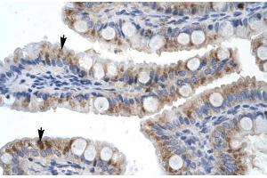 Rabbit Anti-ZNF341 Antibody Catalog Number: ARP30014 Paraffin Embedded Tissue: Human Intestine Cellular Data: Epithelial cells of intestinal villas Antibody Concentration: 4. (ZNF341 antibody  (Middle Region))
