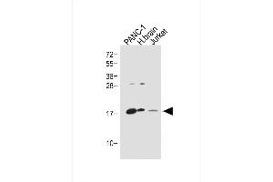 All lanes : Anti-Glucagon Antibody (C-term) at 1:1000 dilution Lane 1: NC-1 whole cell lysate Lane 2: Humanbrain lysate Lane 3: Jurkat whole cell lysate Lysates/proteins at 20 μg per lane. (Glucagon antibody  (C-Term))