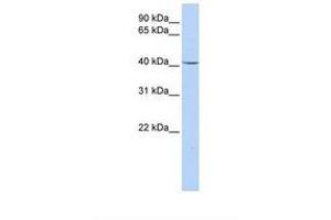 Image no. 1 for anti-Glycerol-3-Phosphate Dehydrogenase 1 (Soluble) (GPD1) (AA 110-159) antibody (ABIN6738025) (GPD1 antibody  (AA 110-159))