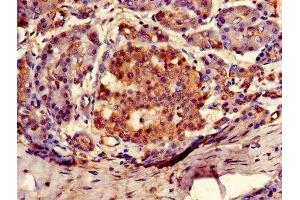 Immunohistochemistry of paraffin-embedded human pancreatic tissue using ABIN7144693 at dilution of 1:100 (ARSG antibody  (AA 17-525))