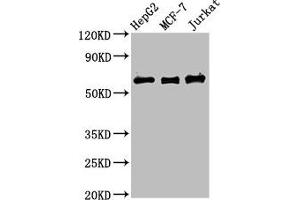 Western Blot Positive WB detected in: HepG2 whole cell lysate, MCF-7 whole cell lysate, Jurkat whole cell lysate All lanes: PRUNE1 antibody at 4 μg/mL Secondary Goat polyclonal to rabbit IgG at 1/50000 dilution Predicted band size: 51, 43, 31, 27, 25, 19 kDa Observed band size: 60 kDa (Exopolyphosphatase PRUNE1 (PRUNE1) (AA 1-168) antibody)