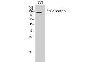 Western Blotting (WB) image for anti-Selectin P (Granule Membrane Protein 140kDa, Antigen CD62) (SELP) (Internal Region) antibody (ABIN3188020) (P-Selectin antibody  (Internal Region))