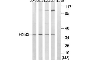 Western blot analysis of extracts from LOVO cells, A549 cells, HUVEC cells and MCF-7 cells, using HOXB2 antibody.