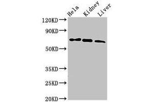 Western Blot Positive WB detected in: Hela whole cell lysate, Mouse kidney tissue, Mouse liver tissue All lanes: MLPH antibody at 3 μg/mL Secondary Goat polyclonal to rabbit IgG at 1/50000 dilution Predicted band size: 66, 63, 53, 61, 51 kDa Observed band size: 66 kDa (Melanophilin antibody  (AA 310-539))