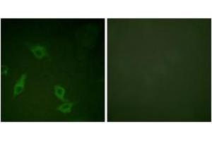 Immunofluorescence analysis of HeLa cells, using FAK (Ab-397) Antibody.