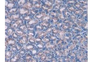 Detection of PTCH1 in Mouse Stomach Tissue using Polyclonal Antibody to Patched Homolog 1 (PTCH1) (Patched 1 antibody  (AA 213-422))