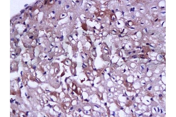 TNNC1 antibody  (AA 131-210)