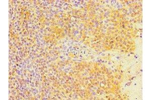 Immunohistochemistry of paraffin-embedded human tonsil tissue using ABIN7165774 at dilution of 1:100 (MTDH antibody  (AA 1-260))