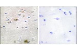 Immunohistochemistry analysis of paraffin-embedded human brain tissue, using TRA-2 alpha Antibody. (TRA2A antibody  (AA 221-270))
