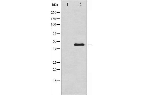 GATA4 antibody  (pSer105)