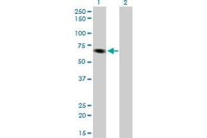Western Blot analysis of ITPKB expression in transfected 293T cell line by ITPKB monoclonal antibody (M01), clone 2F8. (ITPKB antibody  (AA 545-643))