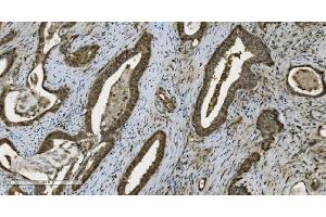 IHC analysis of PARP using anti-PARP antibody (ABIN7602276). (PARP1 antibody  (AA 670-858))