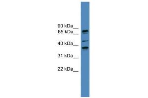 WB Suggested Anti-BBS5 Antibody Titration: 0.