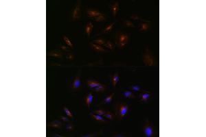 Immunofluorescence analysis of U-251 MG cells using  Rabbit pAb (ABIN7265728) at dilution of 1:100 (40x lens). (ABCA2 antibody  (AA 2307-2466))