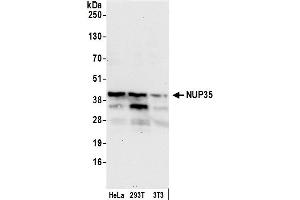 Western Blotting (WB) image for anti-Nucleoporin 35kDa (NUP35) (AA 276-376) antibody (ABIN7454783)