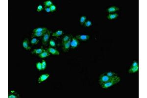 Immunofluorescent analysis of HepG2 cells using ABIN7161378 at dilution of 1:100 and Alexa Fluor 488-congugated AffiniPure Goat Anti-Rabbit IgG(H+L) (Doublecortin antibody  (AA 108-360))