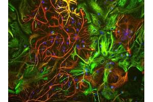 View of mixed neuron/glial cultures stained with ABIN1580468 (green) our rabbit antibody to GFAP antibody (RPCA-GFAP, red). (Vimentin antibody)