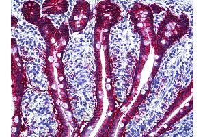 Anti-EPCAM antibody IHC of human intestine. (EpCAM antibody)