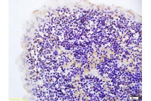 Formalin-fixed and paraffin embedded rat spleen labeled with Anti-Hairless Polyclonal Antibody, Unconjugated (ABIN1387668) at 1:200 followed by conjugation to the secondary antibody and DAB staining. (Hairless antibody  (AA 345-460))