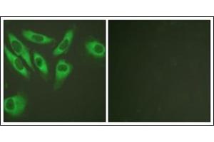 Immunofluorescence analysis of HeLa cells, using S6 Ribosomal Protein.