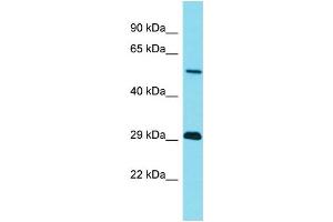 Western Blotting (WB) image for anti-Tripartite Motif Containing 43B (TRIM43B) (N-Term) antibody (ABIN2791466)