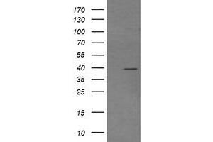 Image no. 2 for anti-Mitogen-Activated Protein Kinase Kinase 3 (MAP2K3) antibody (ABIN1499418) (MAP2K3 antibody)