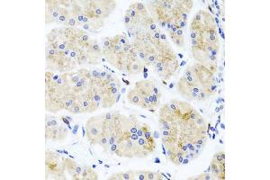 Immunohistochemistry of paraffin-embedded human stomach using ATP7A antibody (ABIN5974582) at dilution of 1/100 (40x lens). (ATP7A antibody)
