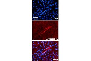 Immunofluorescent staining of human liver with APOBEC3G polyclonal antibody  at 1:100 dilution. (APOBEC3G antibody  (N-Term))