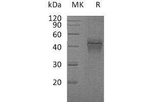 Western Blotting (WB) image for Interferon gamma Receptor 1 (IFNGR1) protein (His tag) (ABIN7320563) (IFNGR1 Protein (His tag))