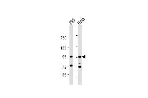 All lanes : Anti-CTNNB1Antibody (C-term) at 1:1000 dilution Lane 1: 293 whole cell lysate Lane 2: Hela whole cell lysate Lysates/proteins at 20 μg per lane. (CTNNB1 antibody  (C-Term))