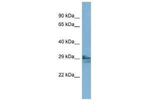 LIM2 antibody used at 1 ug/ml to detect target protein. (LIM2 antibody  (N-Term))