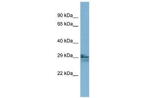 LIM2 antibody used at 1 ug/ml to detect target protein.