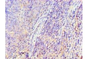 Immunohistochemistry of paraffin-embedded human tonsil tissue using ABIN7153301 at dilution of 1:100 (GRK6 antibody  (AA 1-170))