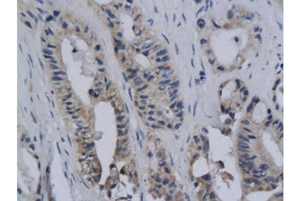 ROS1 antibody  (AA 2231-2347)