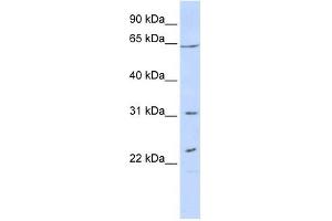 EME1 antibody used at 1 ug/ml to detect target protein. (Crossover junction endonuclease EME1 (EME1) antibody)