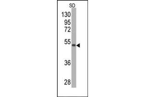 Western Blotting (WB) image for anti-Superoxide Dismutase 2, Mitochondrial (SOD2) antibody (ABIN356396) (SOD2 antibody)