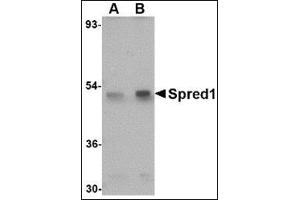 Western blot analysis of Spred1 in mouse brain tissue lysate with this product at (A) 1 and (B) 2 μg/ml.
