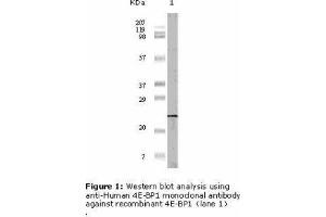 Image no. 1 for anti-Eukaryotic Translation Initiation Factor 4E Binding Protein 1 (EIF4EBP1) antibody (ABIN207632) (eIF4EBP1 antibody)